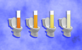 Four test tubes of urine in various stages of cloudiness stand inside of four toilet bowls.