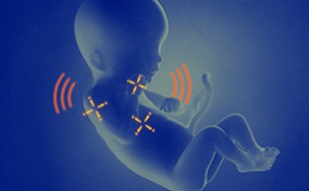 Three yellow crosshairs target over a blue fetus as red sound symbols surround it.