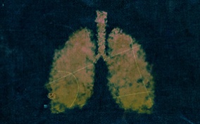 Two watercolor-painted lungs are in yellow and surrounded by navy blue.