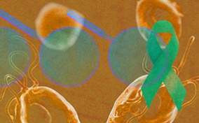 A blue magnifying looks over a yellow-orange prostate with a green cancer ribbon on it. 