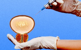 A hand holds an oversized prostate as the other hand uses a needle to inject medicine into it.