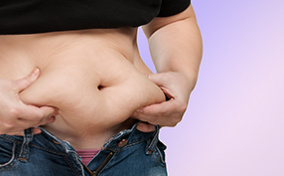 A person holds the skin of their stomach after bariatric weight loss surgery.