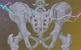 The pelvic region of a skeleton has teal and pink lighting bolts going across it against a cloudy purple and yellow background.