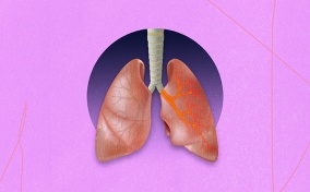 A pair of lungs come through a hole in the pink background with the left showing disease.