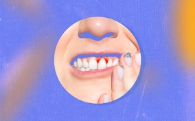 A woman holds the side of her mouth as blood forms around one of her front teeth.