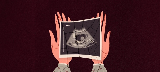 Open-hands-holding-ultrasound-picture