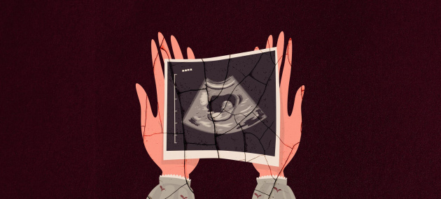 Open-hands-holding-ultrasound-picture