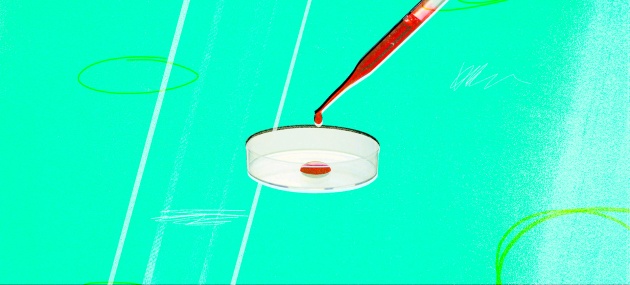 A dropper puts a blood sample into a petri dish against a bright sea foam green background.