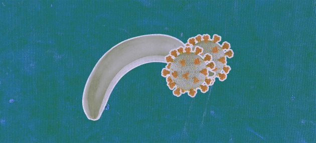 Two COVID-19 cells are next to each other at the end of a banana that is tipping downward.