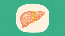 A liver with yellow fat spots sits on a cream colored plate and a green background.