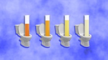 Four test tubes of urine in various stages of cloudiness stand inside of four toilet bowls.