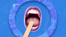 open mouth says "Ahh" with popsicle stick on blue background 